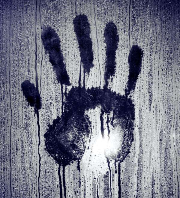 Nadmierna potliwość dłoni